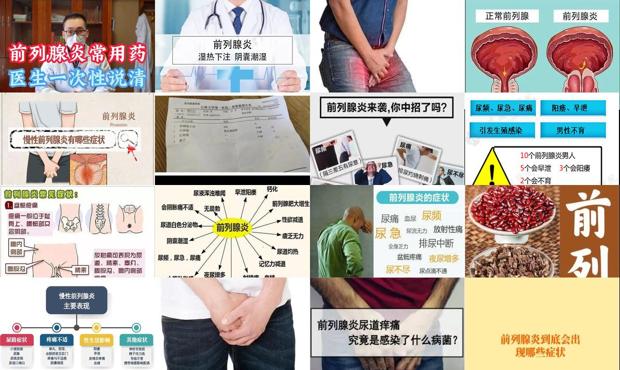 汕头前列腺炎症状是什么
