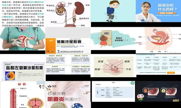 汕头尿道炎症如何治疗