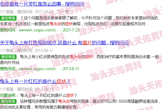 汕头龟头炎症状图片对照