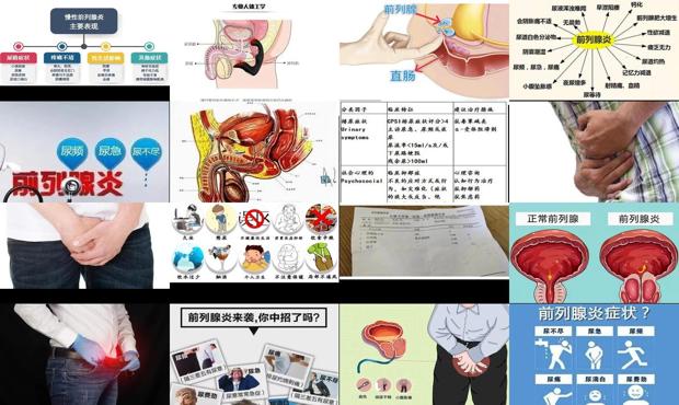 汕头前内腺炎症状