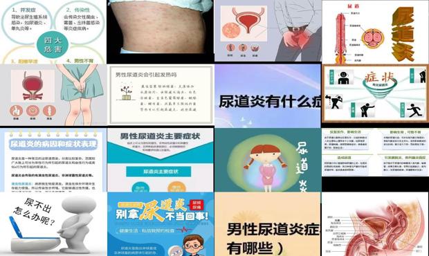 汕头尿道炎症状表现男