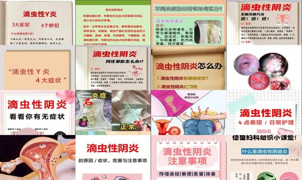汕头滴虫性阴炎症状