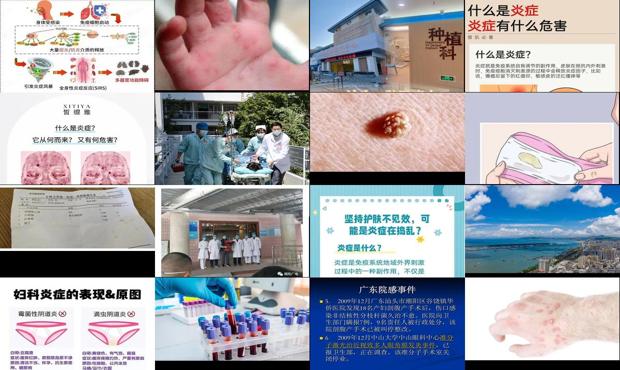 汕头炎症是什么