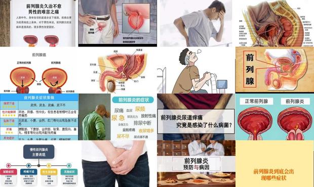 汕头男性前列腺炎症状
