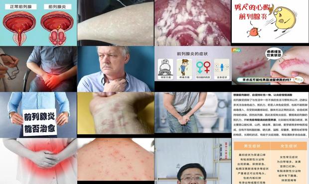 汕头男人炎症什么症状