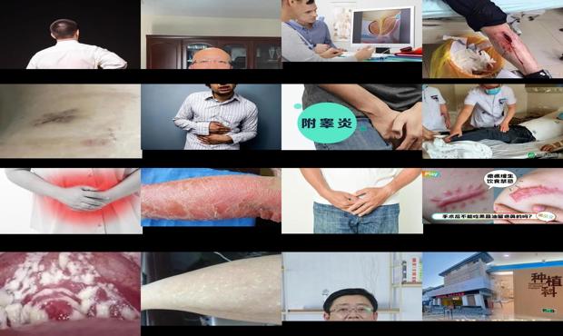 汕头男人炎症