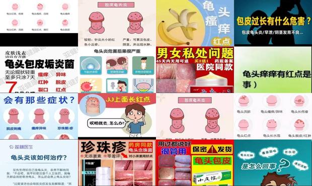 汕头龟头有点炎症怎么办