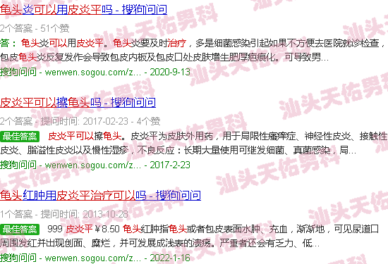 汕头皮炎平可以治疗龟头炎症吗