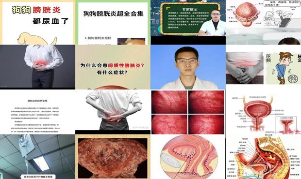 汕头膀胱炎症状有哪些