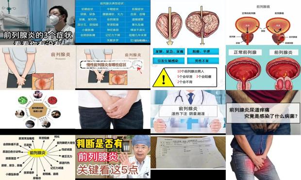 汕头什么是前列腺炎症状