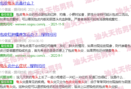 汕头龟头包皮炎症状
