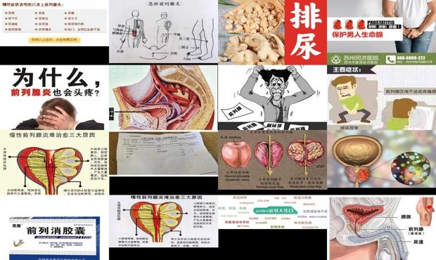 汕头前列腺炎