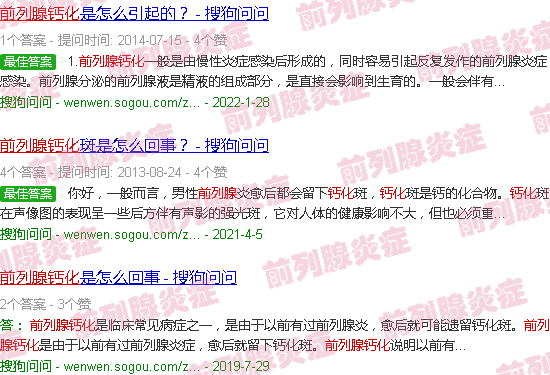汕头前列腺钙化
