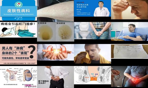 汕头男人下面有炎症是什么症状