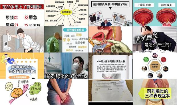 汕头前列腺炎症状是什么感觉