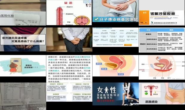 汕头尿道炎症怎么治疗
