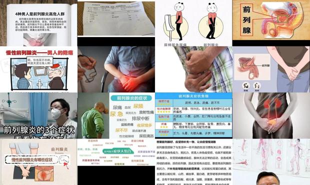 汕头男人前列腺炎症状表现哪些症状