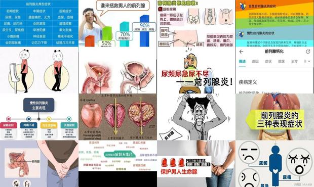 汕头前列腺炎症状晚期