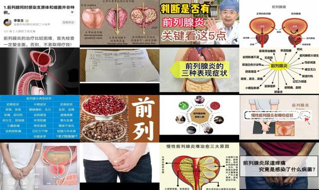 汕头前列腺炎什么症状