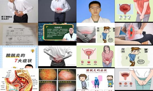 汕头男性膀胱炎症状表现
