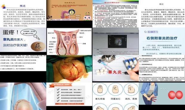 汕头皋丸炎症状