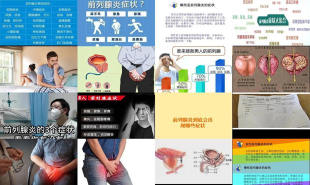 汕头前列腺炎症状有哪些症状