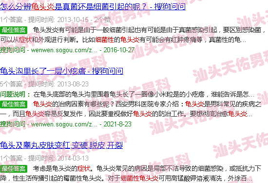 汕头细菌性龟头炎症状