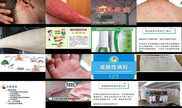 汕头炎症感染有什么症状