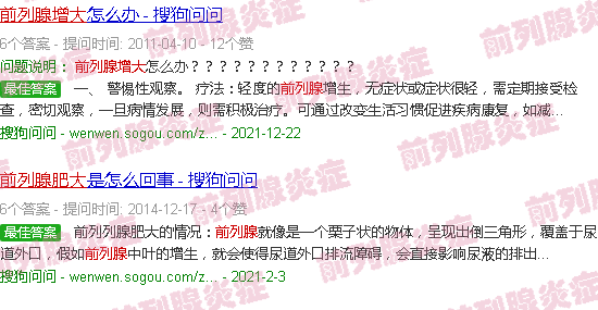 汕头前列腺增大