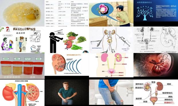 汕头泌尿系炎症
