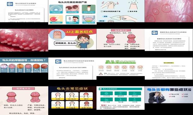 汕头龟头炎症状与治疗方法