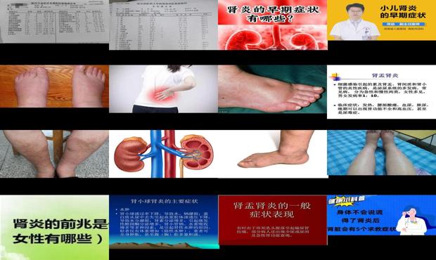 汕头肾炎症状