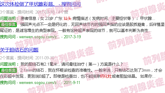 汕头前列腺钙化灶