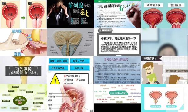 汕头前列腺炎是怎么引起