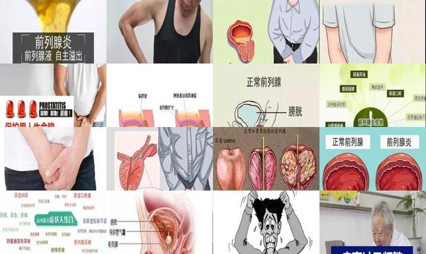 汕头勃不起来是前列腺炎吗