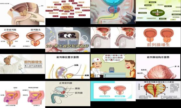 汕头前列腺怎么引起来的