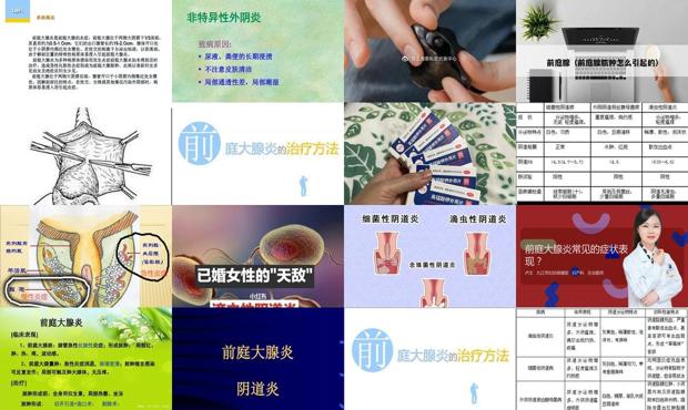 汕头前庭大腺炎症状