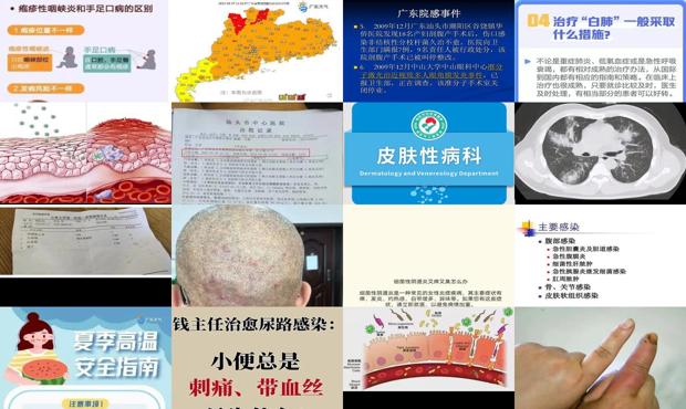 汕头炎症感染是怎么回事