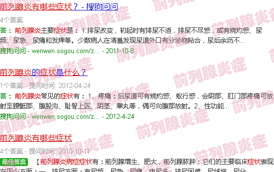 汕头前列腺炎有什么症状啊
