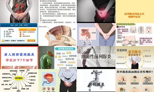 汕头前列腺炎的表现