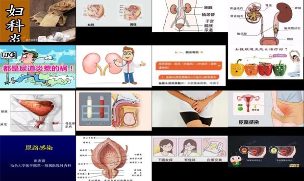 汕头尿道炎症怎样引起的