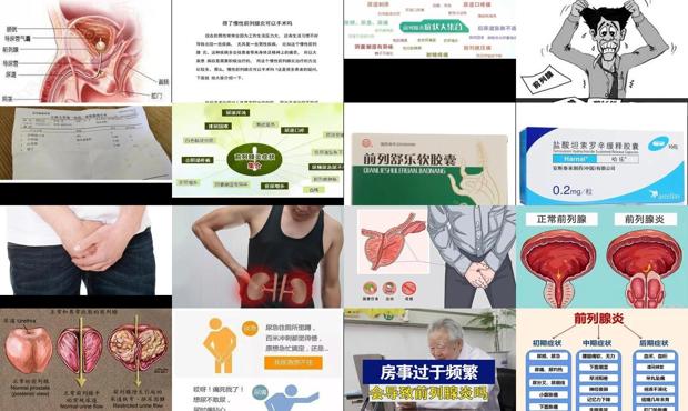 汕头前列腺炎十大西药