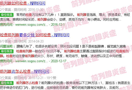 汕头前列腺怎么检查