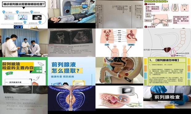 汕头前列腺怎么检查