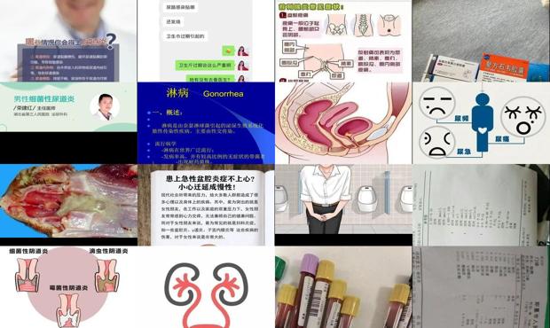 汕头急性尿道炎症