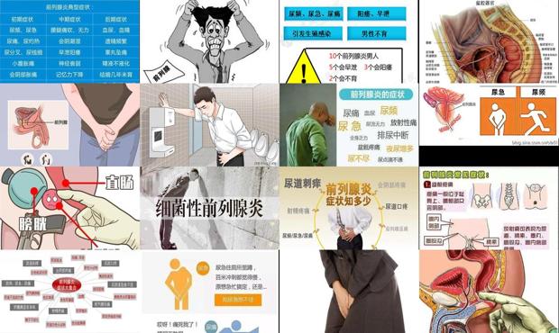 汕头慢性前列腺炎症症状