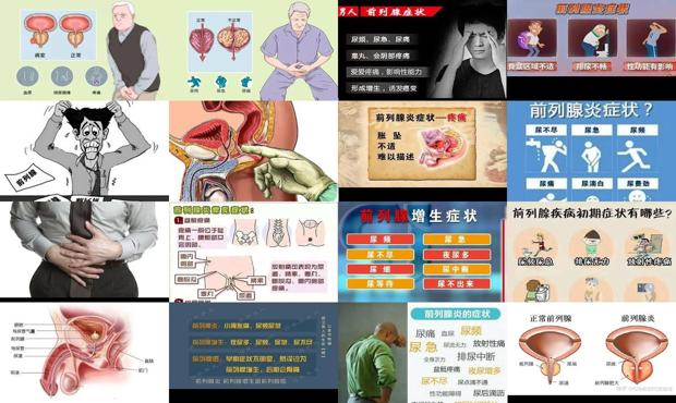 汕头前列腺发炎症状