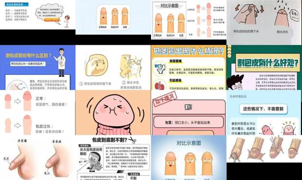汕头有炎症能割包皮吗