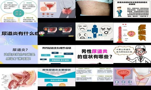 汕头后尿道炎症状表现