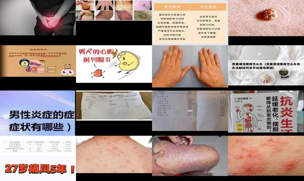 汕头男人炎症是什么症状